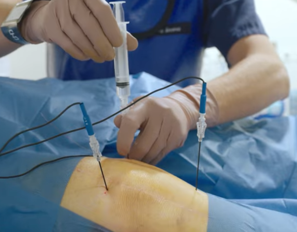 ¿DOLOR TRAS UNA PRÓTESIS DE RODILLA?